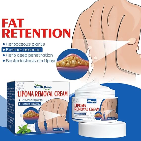 Lipoma Removal Cream | Ramzan Sale