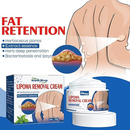 Lipoma Removal Cream | Ramzan Sale